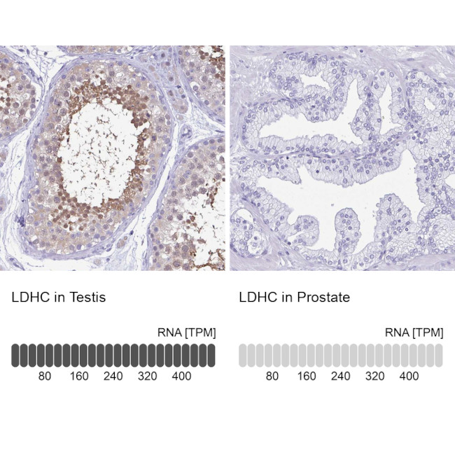 LDHC Antibody