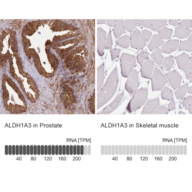ALDH1A3 Antibody in Immunohistochemistry (IHC)