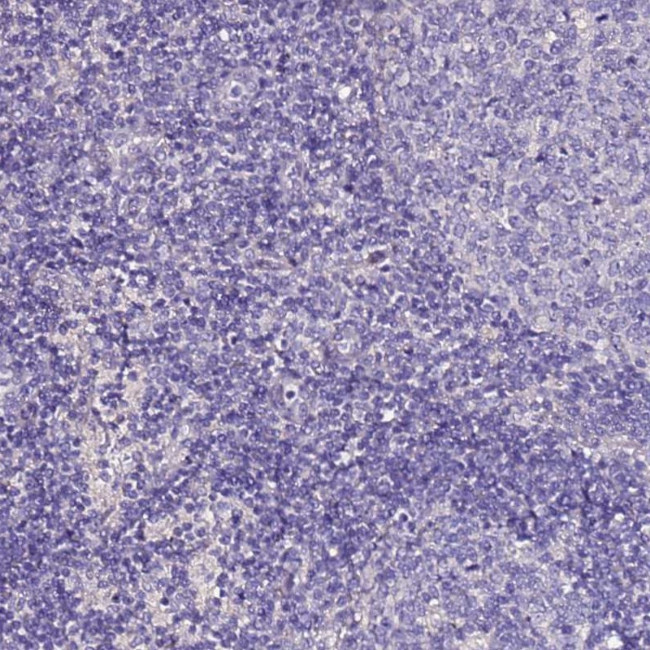 SLC44A3 Antibody in Immunohistochemistry (IHC)