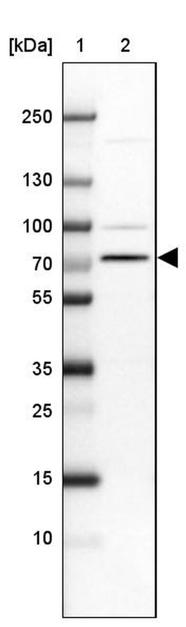 SLC44A3 Antibody in Western Blot (WB)