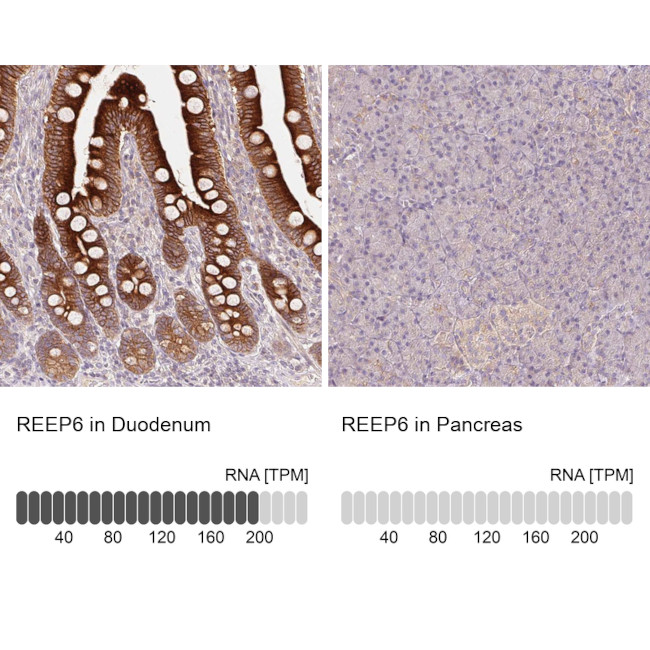 REEP6 Antibody in Immunohistochemistry (IHC)