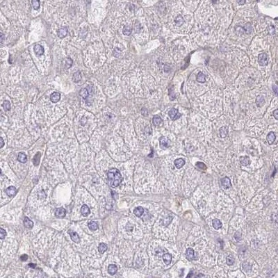 PFDN6 Antibody in Immunohistochemistry (IHC)