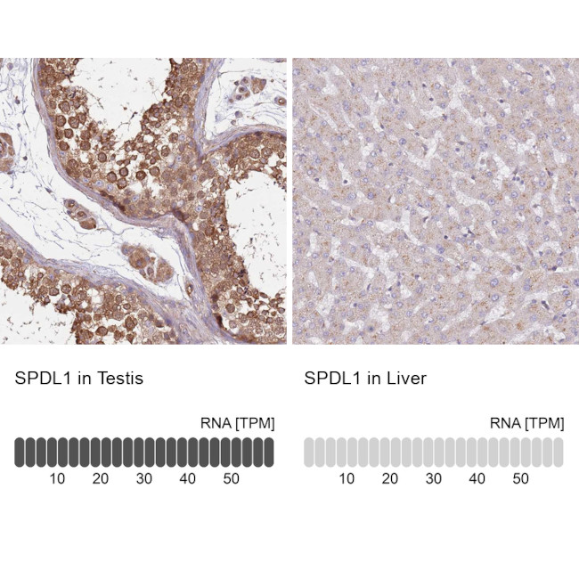 SPDL1 Antibody in Immunohistochemistry (IHC)