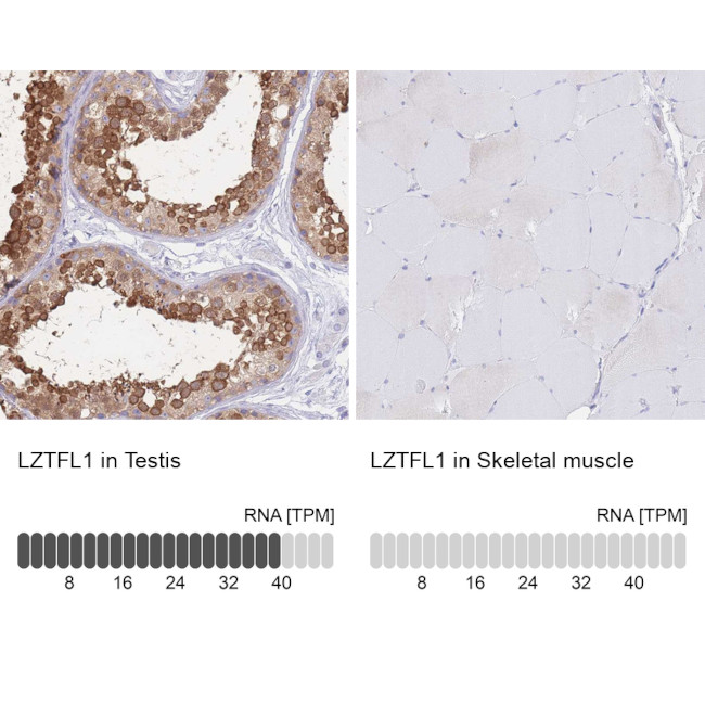 LZTFL1 Antibody