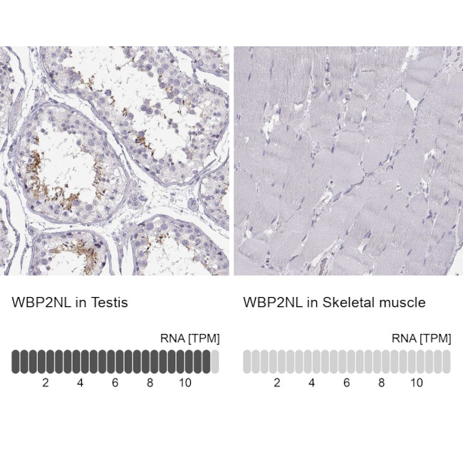 WBP2NL Antibody in Immunohistochemistry (IHC)