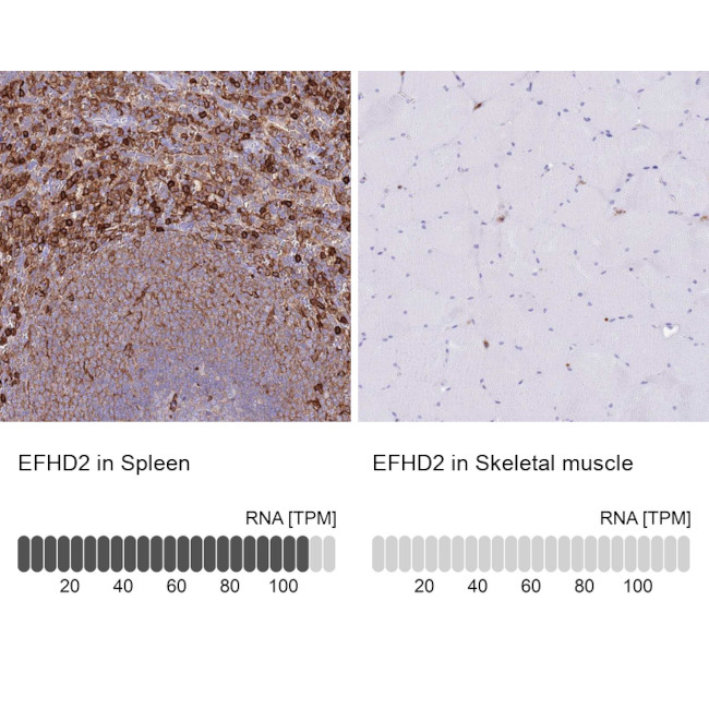 EFHD2 Antibody in Immunohistochemistry (IHC)