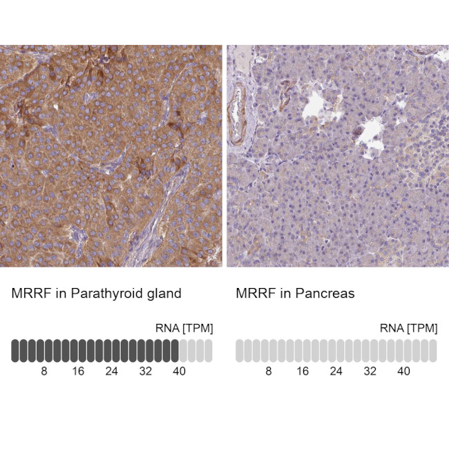MRRF Antibody in Immunohistochemistry (IHC)