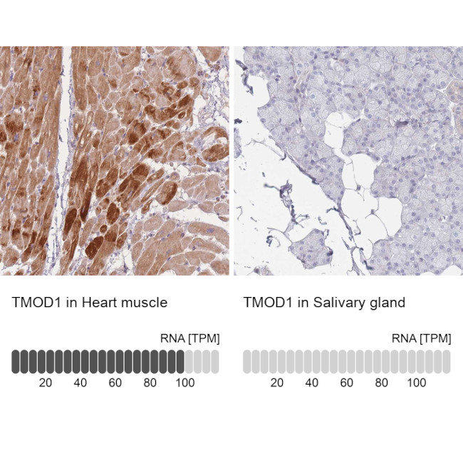 TMOD1 Antibody in Immunohistochemistry (IHC)