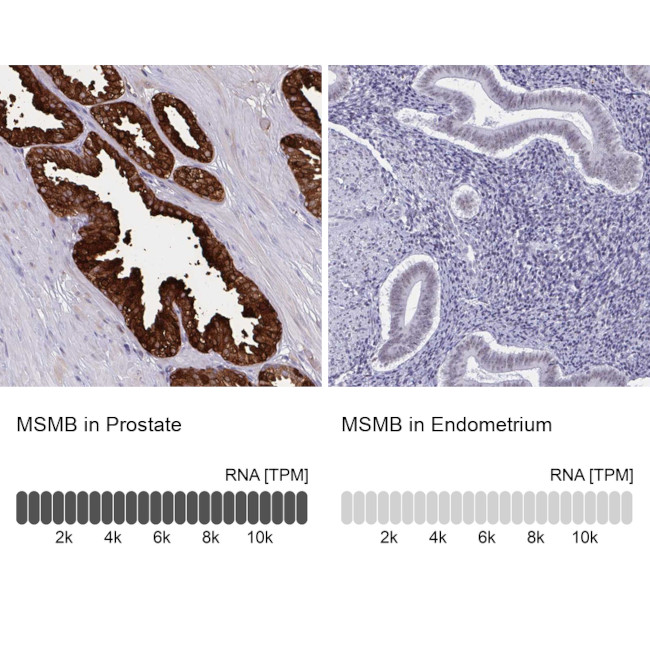 MSMB Antibody in Immunohistochemistry (IHC)