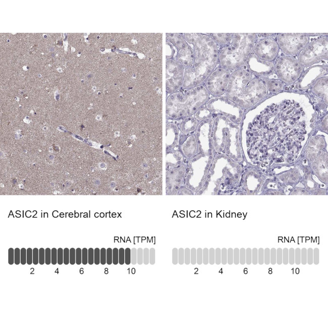 ASIC2 Antibody in Immunohistochemistry (IHC)
