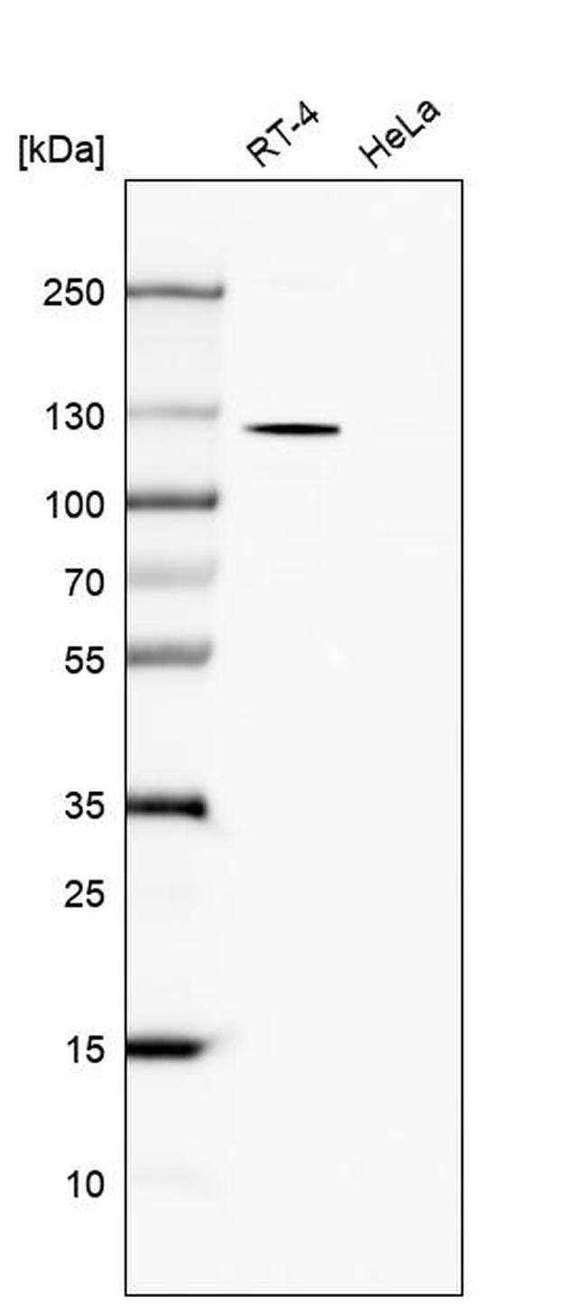 TBC1D2B Antibody in Western Blot (WB)