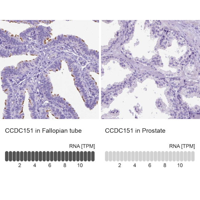 CCDC151 Antibody in Immunohistochemistry (IHC)