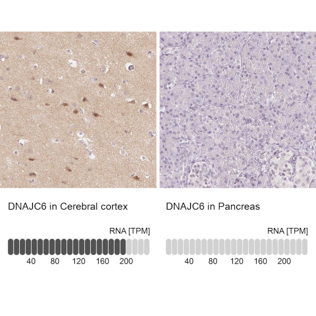 DNAJC6 Antibody in Immunohistochemistry (IHC)