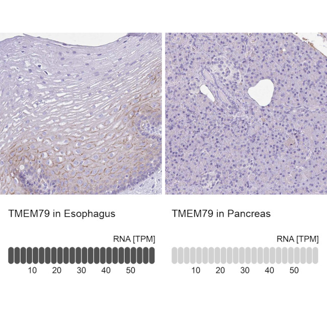 TMEM79 Antibody in Immunohistochemistry (IHC)