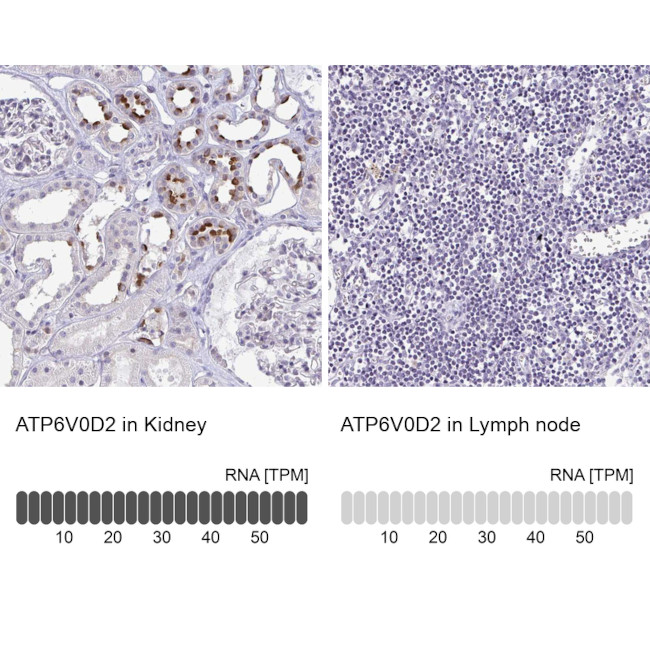 ATP6V0D2 Antibody in Immunohistochemistry (IHC)