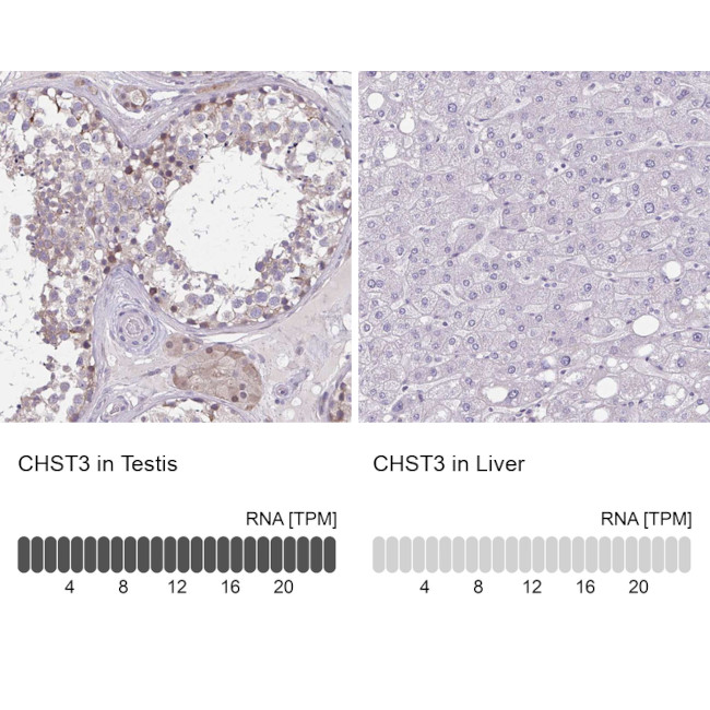 CHST3 Antibody in Immunohistochemistry (IHC)