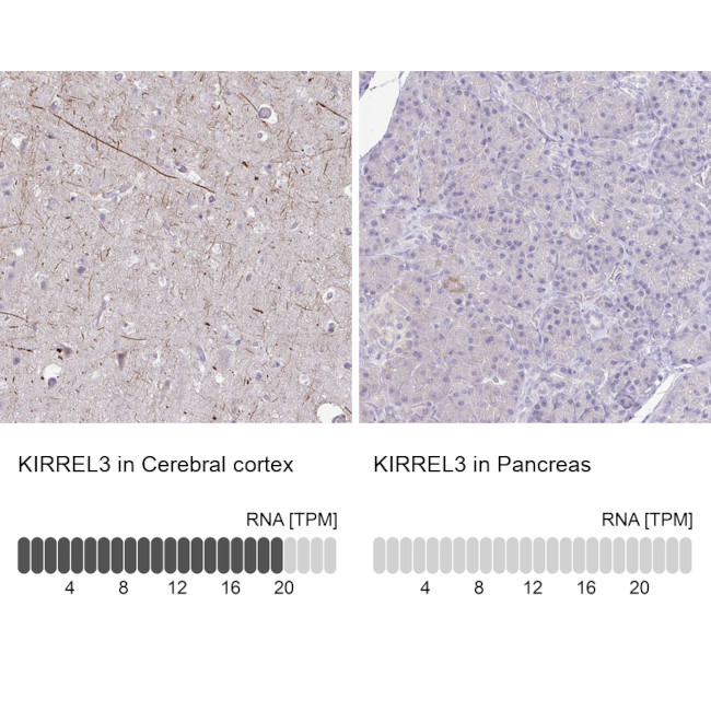 KIRREL3 Antibody in Immunohistochemistry (IHC)