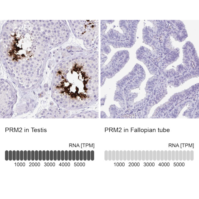 PRM2 Antibody in Immunohistochemistry (IHC)