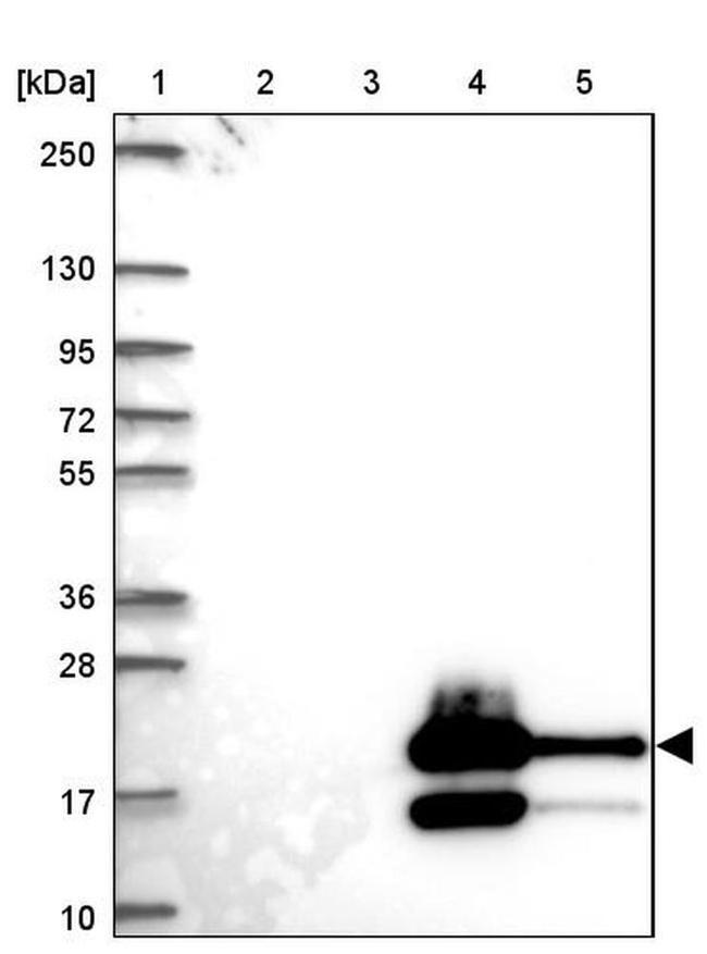 GYLTL1B Antibody in Western Blot (WB)