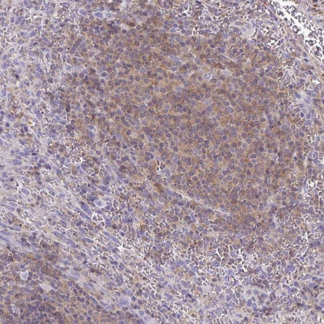 TNFAIP8 Antibody in Immunohistochemistry (IHC)