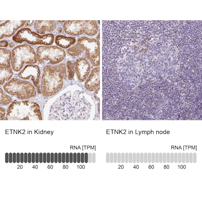 ETNK2 Antibody in Immunohistochemistry (IHC)