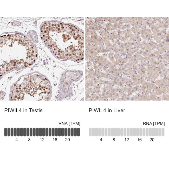 PIWIL4 Antibody in Immunohistochemistry (IHC)