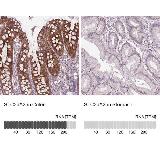 SLC26A2 Antibody in Immunohistochemistry (IHC)