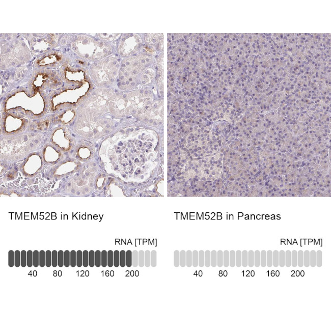 TMEM52B Antibody in Immunohistochemistry (IHC)