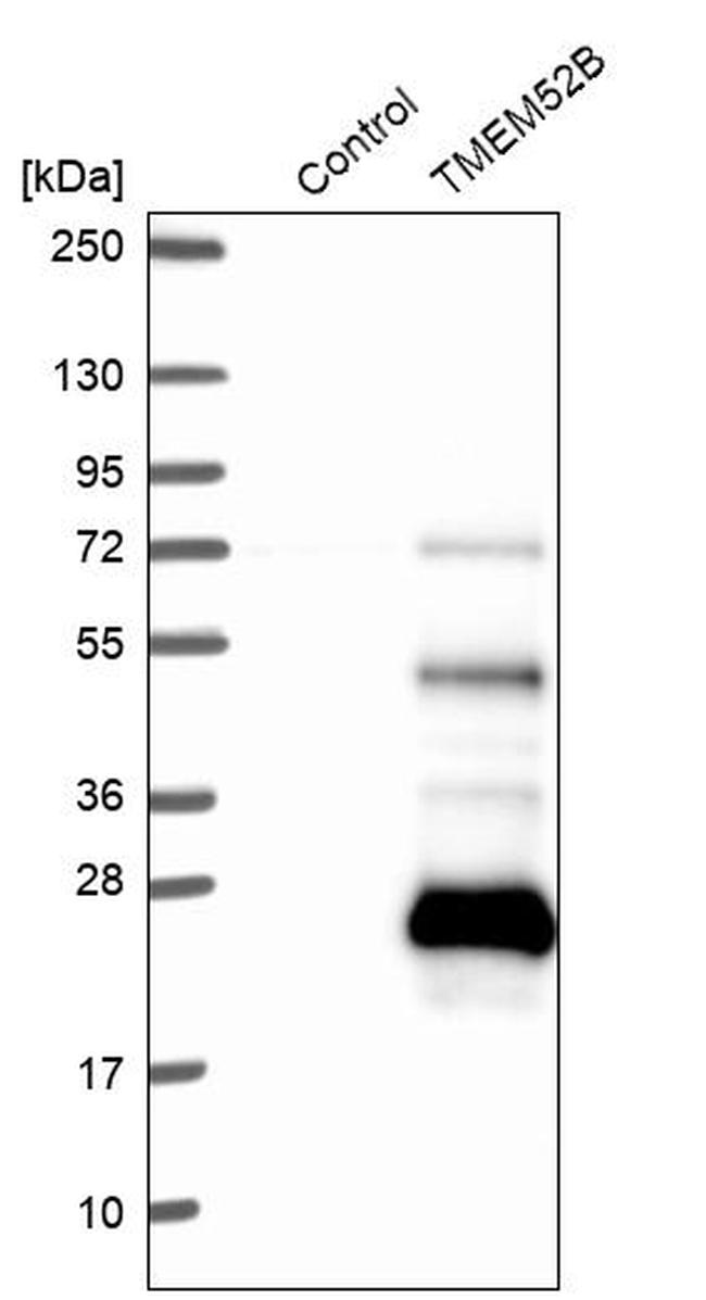 TMEM52B Antibody in Western Blot (WB)