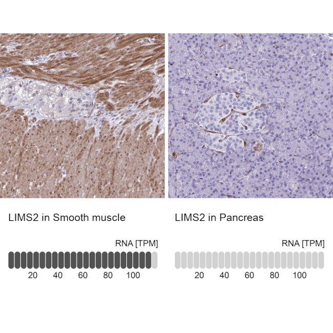 LIMS2 Antibody in Immunohistochemistry (IHC)