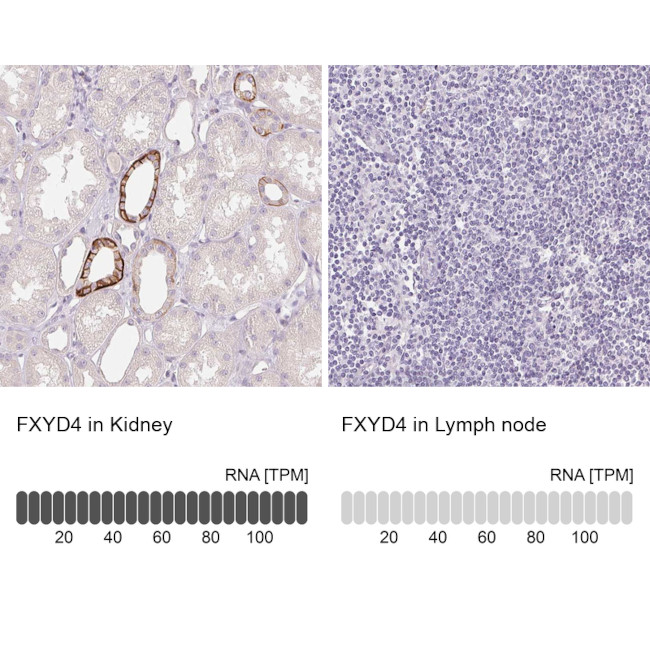 FXYD4 Antibody in Immunohistochemistry (IHC)