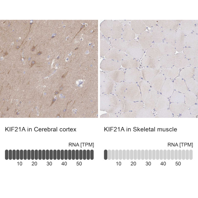 KIF21A Antibody in Immunohistochemistry (IHC)