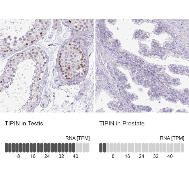 TIPIN Antibody in Immunohistochemistry (IHC)