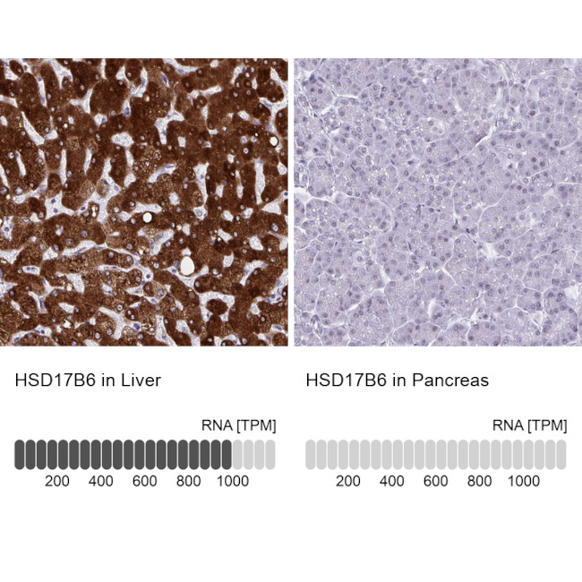 HSD17B6 Antibody in Immunohistochemistry (IHC)