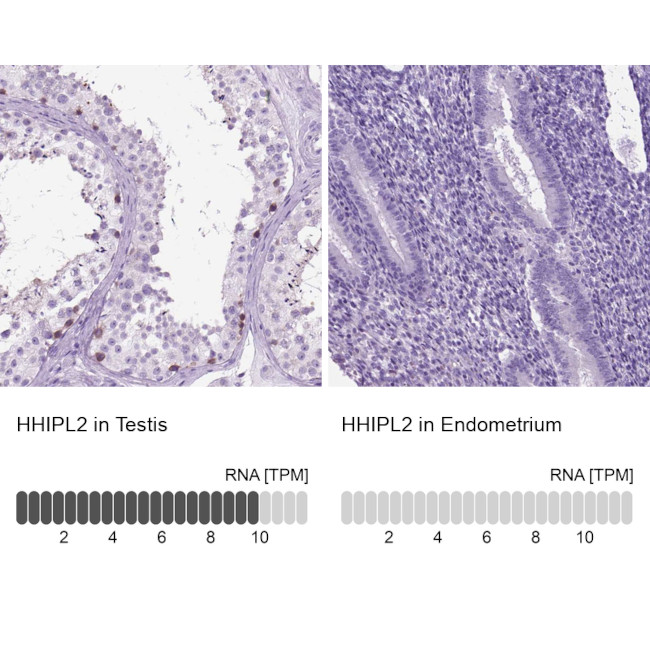 HHIPL2 Antibody in Immunohistochemistry (IHC)