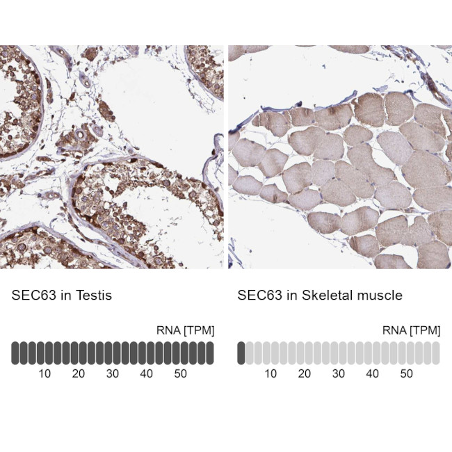 SEC63 Antibody in Immunohistochemistry (IHC)