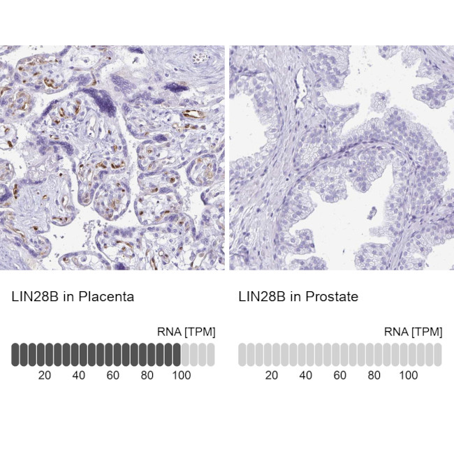LIN28B Antibody in Immunohistochemistry (IHC)