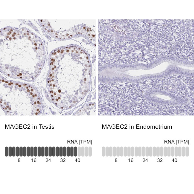 MAGEC2 Antibody in Immunohistochemistry (IHC)