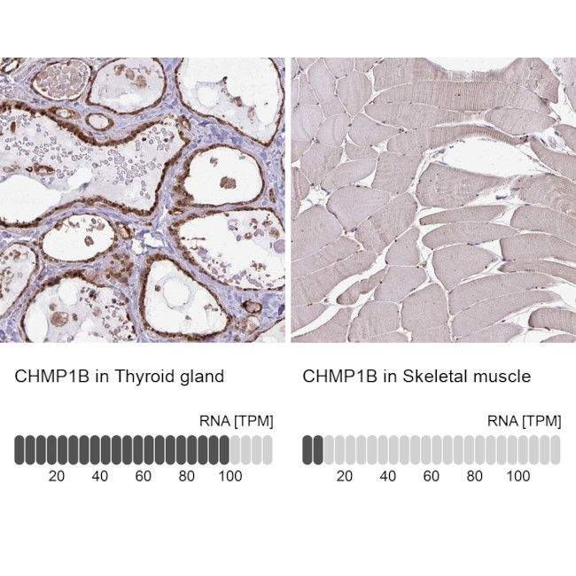 CHMP1B Antibody in Immunohistochemistry (IHC)