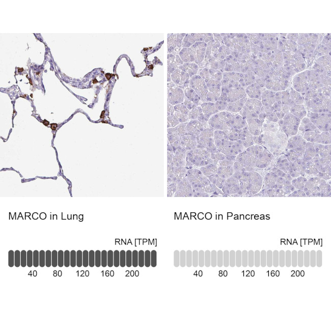 MARCO Antibody in Immunohistochemistry (IHC)