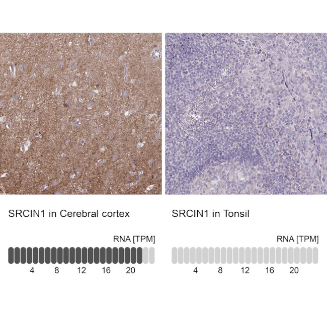 SNIP Antibody in Immunohistochemistry (IHC)
