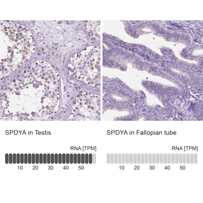 SPDYA Antibody in Immunohistochemistry (IHC)