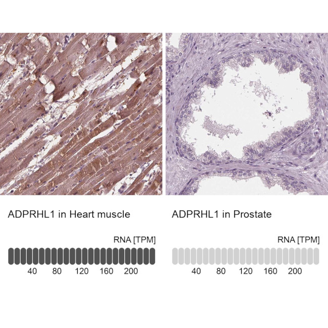 ADPRHL1 Antibody in Immunohistochemistry (IHC)