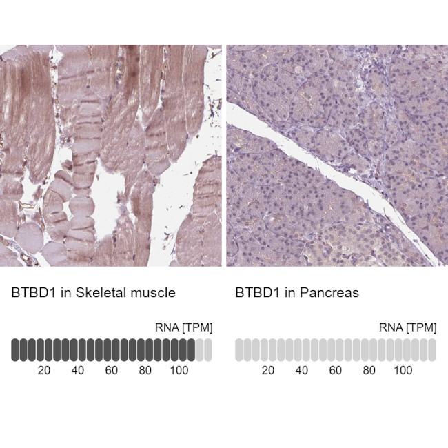 BTBD1 Antibody in Immunohistochemistry (IHC)