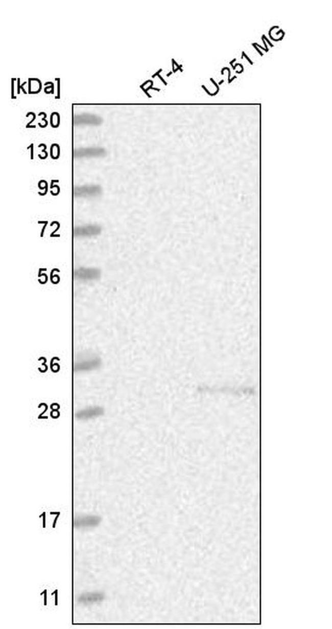 C1orf77 Antibody in Western Blot (WB)