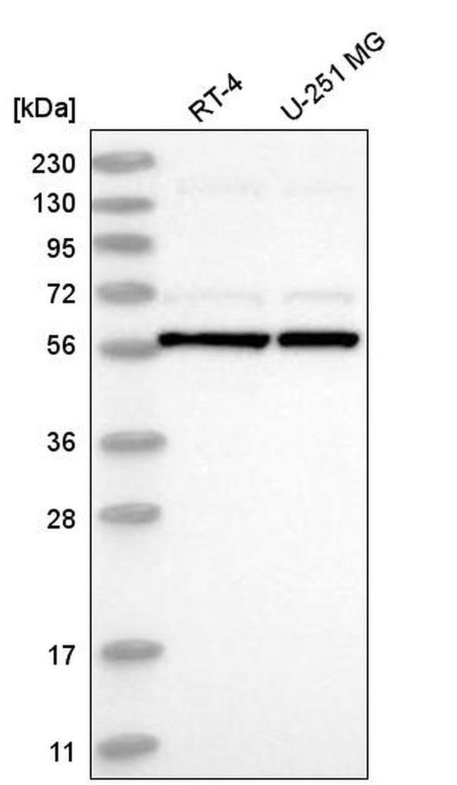 UBXD5 Antibody in Western Blot (WB)