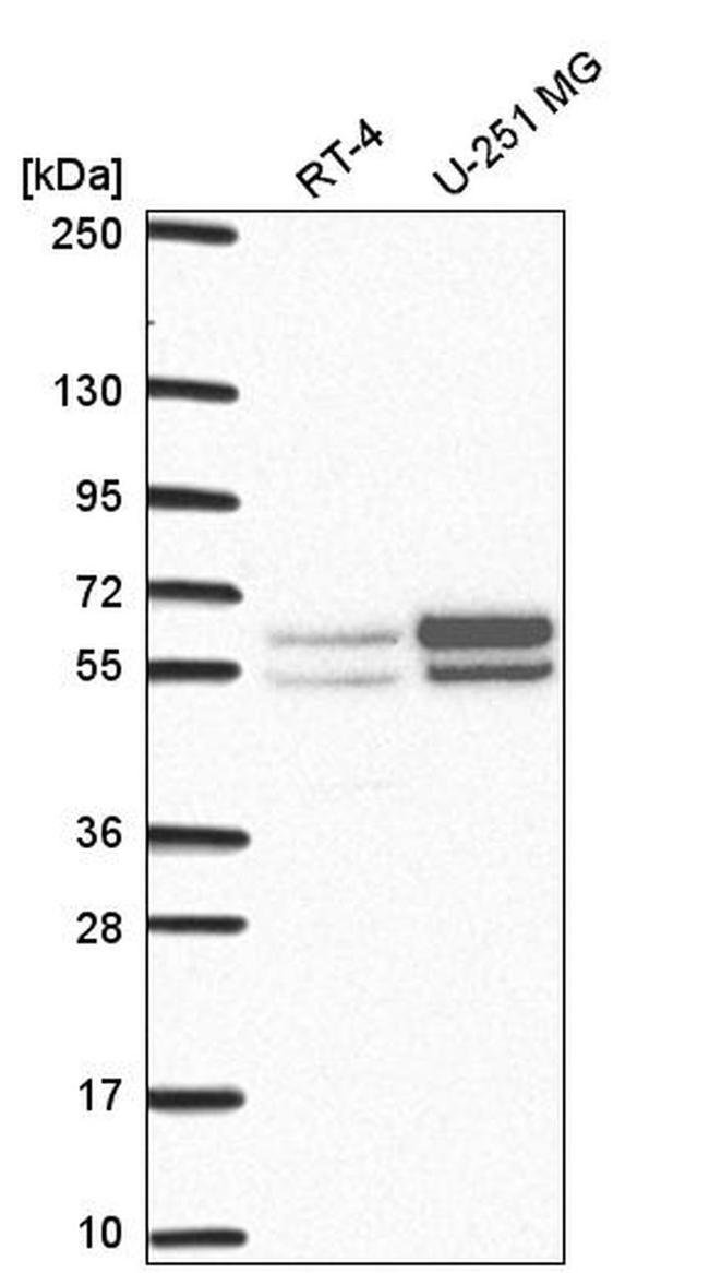 NAP1L2 Antibody in Western Blot (WB)