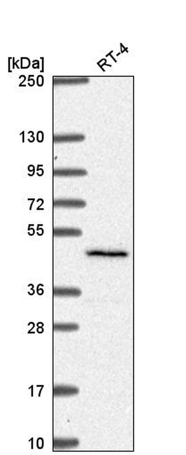 SLC29A3 Antibody in Western Blot (WB)