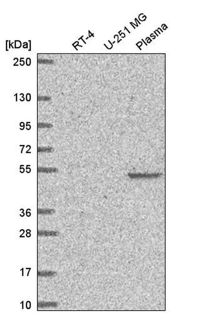 FAM227B Antibody in Western Blot (WB)