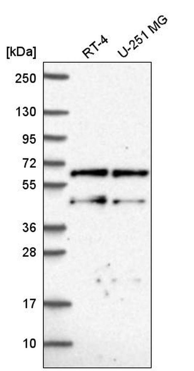 CNOT2 Antibody in Western Blot (WB)